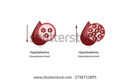 Hyperkalaemia, high plasma potassium level and Hypokalaemia, low plasma potassium level. Potassium K excess and deficit electrolyte disorders, blood test tube, Scientific design. Vector illustration
