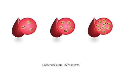Hypernatremia, high plasma sodium level and Hyponatremia, low plasma sodium level. Sodium Na excess and deficit electrolyte disorders, blood test tube, Scientific design. Vector illustration.