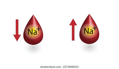 Hypernatremia, high plasma sodium level and Hyponatremia, low plasma sodium level. Sodium Na excess and deficit electrolyte disorders, blood test tube, Scientific design. Vector illustration.