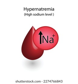 Hypernatremia, high plasma sodium level and Hyponatremia, low plasma sodium level. Sodium Na excess and deficit electrolyte disorders, blood test tube, Scientific design. Vector illustration.