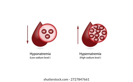 Hipernatremia, níveis plasmáticos elevados de sódio e Hiponatremia, níveis plasmáticos baixos de sódio. Distúrbios eletrolíticos de excesso e deficit de sódio na, tubo de exame de sangue, desenho científico. Ilustração vetorial.
