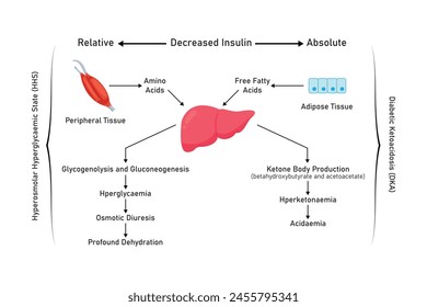 Diseño Científico del Estado Hiperglucémico Hiperosmolar (EHH) y Cetoacidosis Diabética (CAD). Ilustración vectorial.