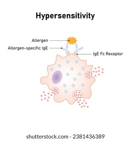 Diseño científico de reacciones de hipersensibilidad. Ilustración vectorial.	