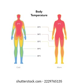 Hyperthermia and hypothermia health care infographic. Vector flat healthcare illustration. Body infrared heat map with celsius symbol isolated on white background.