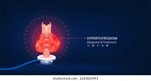 Hyperthyroidism disease, Human thyroid gland model float away from stethoscope. Doctor diagnosis treatment. Medical technology innovation concept. Banner design for pharmacy clinic. 3d Vector.