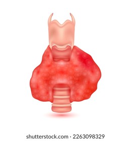 Hyperthyroidism disease, Human thyroid gland anatomy model isolated on a white background. Main organ of the human body. Medicine and science concept. 3D Vector.