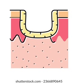 hypertrophic acne scar color icon vector. hypertrophic acne scar sign. isolated symbol illustration