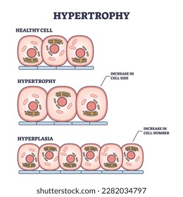 Hypertrophy, hyperplasia or healthy muscular cells comparison outline diagram. Labeled educational scheme with increased cellular fluid after weight lifting or increase amount vector illustration.