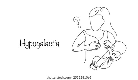 Hipogalactia. Uma patologia em que os seios de uma mulher amamentando produzem muito pouco leite. Uma mãe alimenta sua fórmula de bebê devido à falta de leite materno. Vetor.