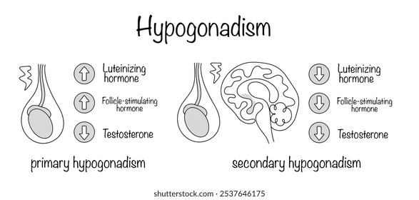 Hypogonadism. A pathological condition that develops against the background of testicular dysfunction or malfunction of the pituitary gland in men. Hand-drawn diagram of the occurrence of hypogonadism