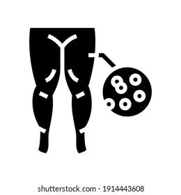 hypoproteinemic edema glyph icon vector. hypoproteinemic edema sign. isolated contour symbol black illustration