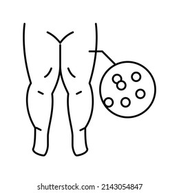 Ikone des hypoproteinämischen Ödems, Vektorgrafik. Symptome eines hypoproteinämischen Ödems. isoliertes Kontursymbol