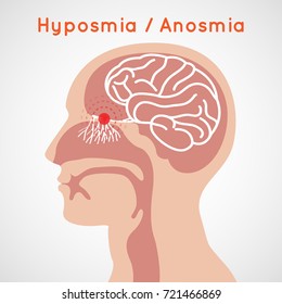 Anosmia: Imágenes, fotos de stock y vectores | Shutterstock