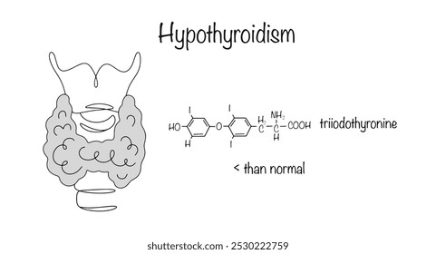 Hipotireoidismo. Doença endocrinológica manifestada por produção insuficiente de hormônios tireoidianos. Uma glândula tireoide puxada à mão e o principal hormônio que está faltando no corpo. Ilustração vetorial.