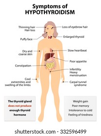Hypothyroidism or low thyroid and hypothyreosis. common disorder of the endocrine system in which the thyroid gland does not produce enough thyroid hormone. Signs and Symptoms thyroid dysfunction