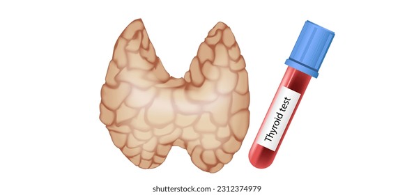 hypothyroidism vs hyperthyroidism. healthy and unhealthy thyroid test. Thyroid tumour and inflammation treatment. Parathyroid glands. neck pain and sore. Throat cancer and esophagus. Goitre problem. 