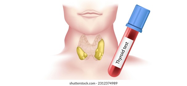 hypothyroidism vs hyperthyroidism. healthy and unhealthy thyroid test. Thyroid tumour and inflammation treatment. Parathyroid glands. neck pain and sore. Throat cancer and esophagus. Goitre problem. 