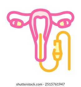 vetor de ícone de cor da cirurgia de histeroscopia. sinal de cirurgia de histeroscopia. ilustração de símbolo isolado