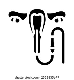 hysteroscopy surgery glyph icon vector. hysteroscopy surgery sign. isolated symbol illustration