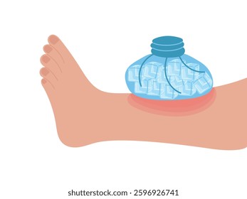 Ice pack applied to leg with bruise, wound. Vector illustration of first aid for injuries, ice cubes. Removal of swelling, puffiness.