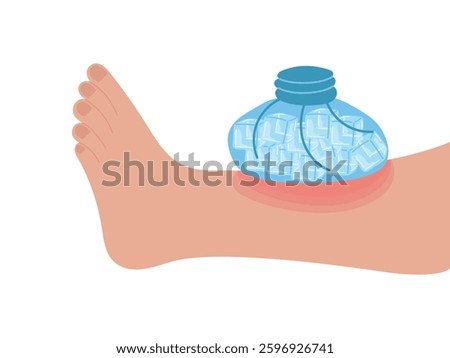 Ice pack applied to leg with bruise, wound. Vector illustration of first aid for injuries, ice cubes. Removal of swelling, puffiness.