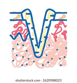 ice pick acne scar doodle icon sketch vector. ice pick acne scar sign. isolated symbol illustration