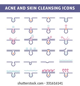 Icon Acne, Schematic View Of A Derma Care, Problem Skin With Pimple In Section