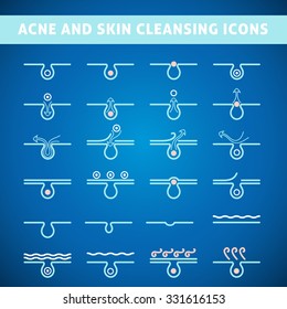 icon acne, schematic view of a derma care, problem skin with pimple in section