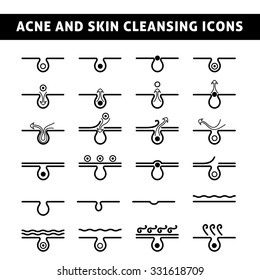 icon acne, schematic view of a skin care, problem skin with acne in section, black and white image