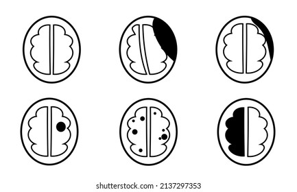 icon of CT brain pathology