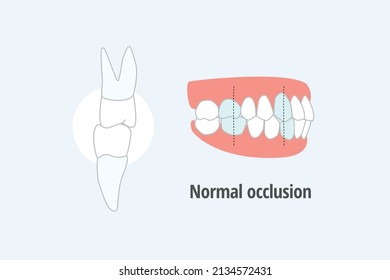 icon dental problem. vectorial illustration normal occlusion