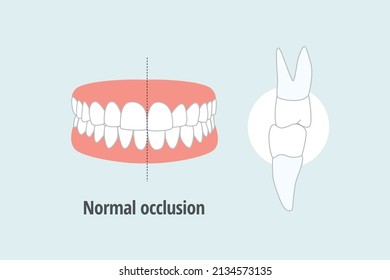 Icon Dental Problem. Vectorial Illustration  Normal Occlusion