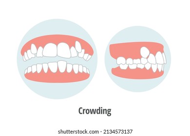 icon dental problem. vectorial illustration Crowding front and lateral