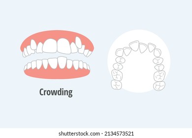 icon dental problem. vectorial illustration  Crowding