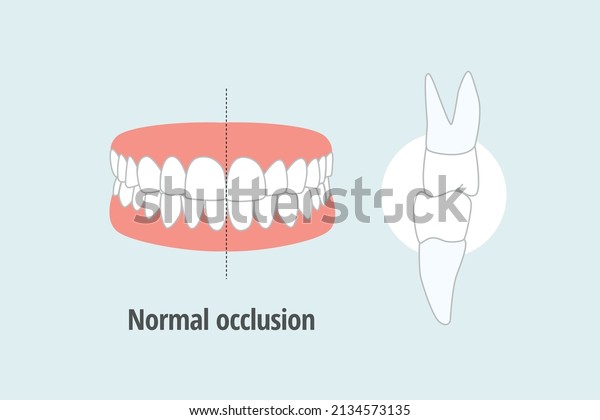 icon dental problem. vectorial illustration \
Normal Occlusion