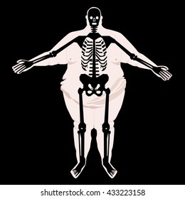 Icon of obese man