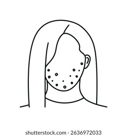 Icon on the theme of acne, drawn with thin lines. It depicts a girl's face with pimples on her cheeks and chin, illustrating common skin concerns for dermatology, skincare, and medical-related visuals