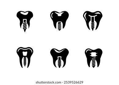 Conjunto de ícones que representa as variações e estruturas do implante dentário Ilustração do vetor de logotipo isolada sobre fundo branco