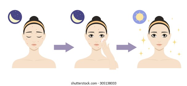 Icon set for skincare infographic. Colorful vector image illustrated steps of washing of pretty woman with acne. Cute cartoon girl with skin problem shows the result of using care cosmetic product.