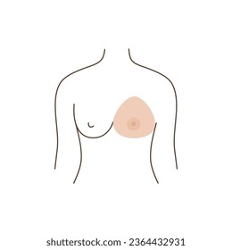 Icon Woman after mastectomy. A girl without breasts tries on a breast prosthesis. Breast cancer. Vector illustration.