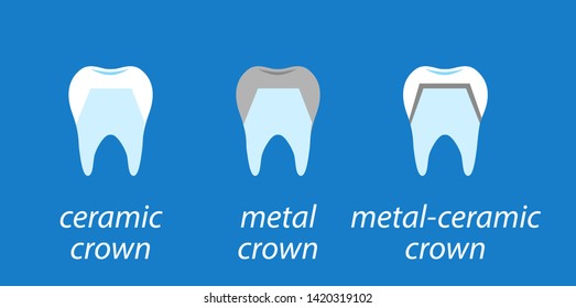 Icons dental on blue background. Service installation of a ceramic crown. As well as a metal and crown on the tooth. Set icons flat style.
