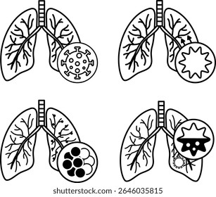 Iconos de enfermedades pulmonares, bronquitis, EPOC y neumonía. Iconos vectoriales de diversas enfermedades pulmonares. Salud y Medicina