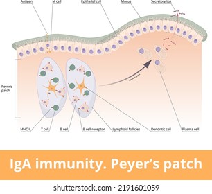 IgA Immunität. Peyers Pflaster. Lymphoide Follikel des Dünndarms erzeugen IgA-Immunantwort mit B-Zellen, T-Zellen, dendritischen Zellen und Plasmazellen, die IgA ausschütten.