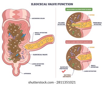 Ileocecal valve function shown with small intestine, large intestine, and valve illustrating one-way flow of chyme and prevention of backflow. Outline diagram