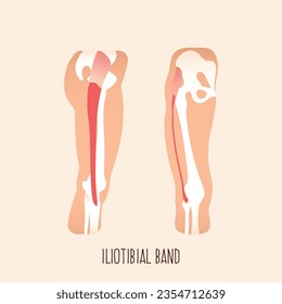 Iliotibial tract vector illustration. Iliotibial band. 