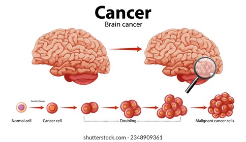 Illustrated guide to brain cancer and abnormal cell growth
