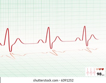 Illustrated Heartbeat Monitor With A Readout And Copy Space