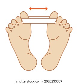 Illustrated illustration of hallux valgus. Gymnastics to cure deformed toes. Hohmann gymnastics.