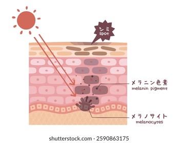 Illustrated illustration of stains seen in a cross-sectional view of the skin