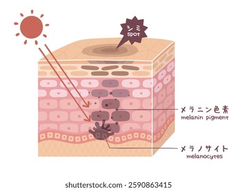 Illustrated illustration of stains seen in a cross-sectional view of the skin